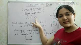 Tetralogy of Fallot by M Mazwi  OPENPediatrics [upl. by Athene61]