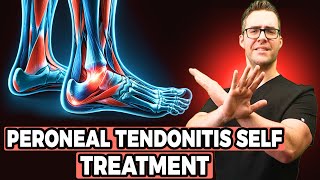 Peroneal Tendonitis Self Treatment Stretches Exercises amp Massage [upl. by Irianat]