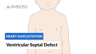 Ventricular Septal Defect VSD  Heart Auscultation  Episode 11 [upl. by Kieffer]