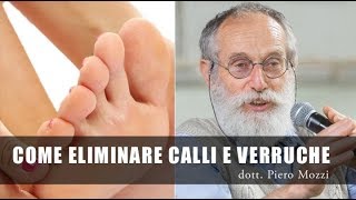 Come eliminare calli e verruche  Dr Mozzi [upl. by Corette]