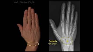 Anatomy of Hand XraysRevised [upl. by Myrtia]