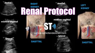 Renal Ultrasound Protocol [upl. by Fern]