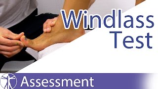 The Windlass Test  Plantar Fasciitis [upl. by Sosanna]