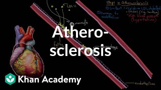 Atherosclerosis  Circulatory System and Disease  NCLEXRN  Khan Academy [upl. by Nekal570]