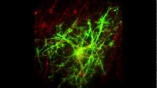 Myelination in Action [upl. by Biancha]