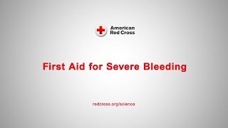 First Aid for Severe Bleeding [upl. by Nason878]