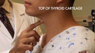 The Thyroid Exam Stanford Medicine 25 [upl. by Healy]