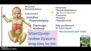 Why Jaundice is Seen in Classic Galactosemia [upl. by Orual]