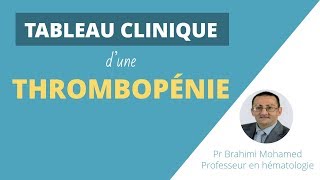 TABLEAU CLINIQUE DUNE THROMBOPENIE [upl. by Anoirb97]