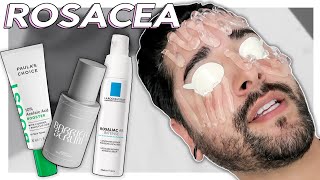 Dealing With amp Managing Rosacea  IPL Azelaic Acid barrier Repair ✖ James Welsh [upl. by Erodasi395]