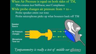 The Tympanogram [upl. by Droffig]