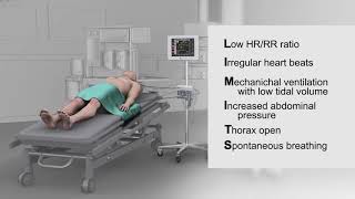 Methods for Assessing Fluid Responsiveness [upl. by Florie541]