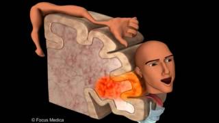 Primary Motor Cortex  Neuroanatomy [upl. by Joaquin334]