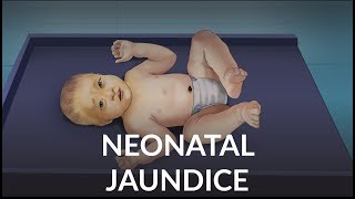 Neonatal Jaundice by L Veit  OPENPediatrics [upl. by Woodcock]