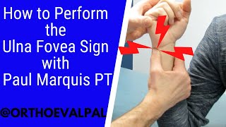 How to Perform the Ulna Fovea Sign with Paul Marquis PT [upl. by Mehala]