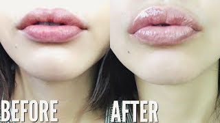 HOW TO GET BIGGER LIPS NATURALLY WITHOUT MAKEUP [upl. by Ydnyl]