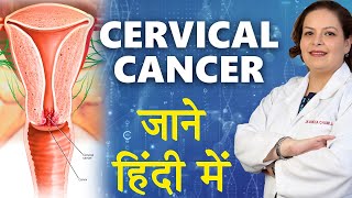 Cervical Cancer In Hindi  गर्भाशय कैंसर जाने हिंदी में  Dr Shikha Chawla [upl. by Eenel756]