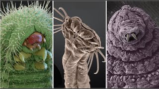 Astonishing Electron Microscope Images [upl. by Haig]