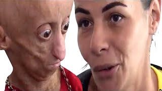 Reportage special RANIA Complet Interview avec sa Mere Maladie Progeria Nanisme Didek74 [upl. by Lewanna344]