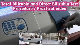 Total Bilirubin and Direct Bilirubin Test Procedure Practical Video [upl. by Clarance512]