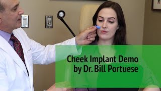 How Do Cheek Implants Work With Facial Plastic Surgeon  Dr William Portuese  Seattle Washington [upl. by Llenreb]